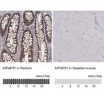 MTMR11 Polyclonal Antibody