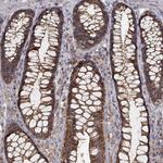 MTMR11 Antibody in Immunohistochemistry (Paraffin) (IHC (P))