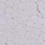 MTMR11 Antibody in Immunohistochemistry (Paraffin) (IHC (P))