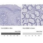HLA-DQB2 Polyclonal Antibody