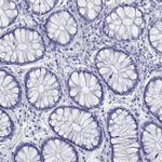 HLA-DQB2 Antibody in Immunohistochemistry (Paraffin) (IHC (P))