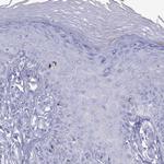 HLA-DQB2 Antibody in Immunohistochemistry (Paraffin) (IHC (P))