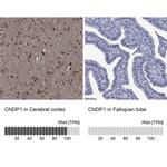 CNDP1 Polyclonal Antibody