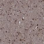 CNDP1 Antibody in Immunohistochemistry (Paraffin) (IHC (P))