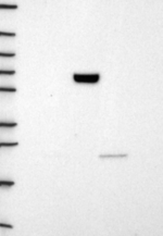 CNDP1 Antibody in Western Blot (WB)