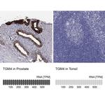 TGM4 Polyclonal Antibody