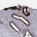 TGM4 Antibody in Immunohistochemistry (Paraffin) (IHC (P))