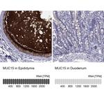 MUC15 Antibody in Immunohistochemistry (Paraffin) (IHC (P))