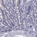 MUC15 Antibody in Immunohistochemistry (Paraffin) (IHC (P))