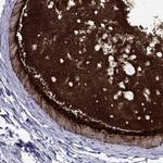 MUC15 Antibody in Immunohistochemistry (Paraffin) (IHC (P))