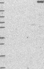 DOCK8 Antibody in Western Blot (WB)