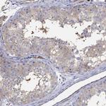 TEKT3 Antibody in Immunohistochemistry (Paraffin) (IHC (P))