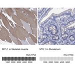 MYL1 Polyclonal Antibody