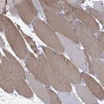 MYL1 Antibody in Immunohistochemistry (Paraffin) (IHC (P))