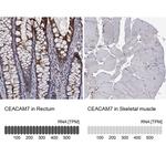 CEACAM7 Polyclonal Antibody