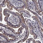 CEACAM7 Antibody in Immunohistochemistry (Paraffin) (IHC (P))