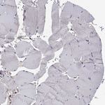 CEACAM7 Antibody in Immunohistochemistry (Paraffin) (IHC (P))