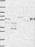 OCT2 Antibody in Western Blot (WB)