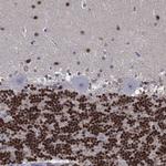 ZNF238 Antibody in Immunohistochemistry (Paraffin) (IHC (P))
