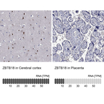 ZNF238 Polyclonal Antibody