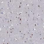 ZNF238 Antibody in Immunohistochemistry (Paraffin) (IHC (P))