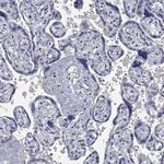 ZNF238 Antibody in Immunohistochemistry (Paraffin) (IHC (P))