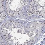 ZNF238 Antibody in Immunohistochemistry (Paraffin) (IHC (P))