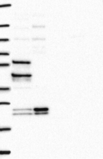 ZNF238 Antibody in Western Blot (WB)