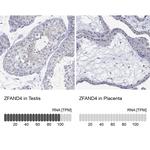 ZFAND4 Polyclonal Antibody