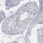 ZFAND4 Antibody in Immunohistochemistry (Paraffin) (IHC (P))
