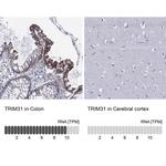 TRIM31 Polyclonal Antibody
