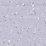 TRIM31 Antibody in Immunohistochemistry (Paraffin) (IHC (P))
