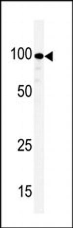 KSR1 Polyclonal Antibody