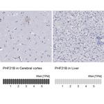 PHF21B Polyclonal Antibody