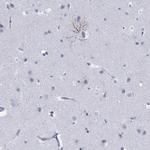 PHF21B Antibody in Immunohistochemistry (Paraffin) (IHC (P))