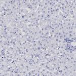 PHF21B Antibody in Immunohistochemistry (Paraffin) (IHC (P))