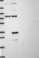 Thymidylate Synthase Antibody in Western Blot (WB)