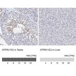 V-ATPase E2 Polyclonal Antibody