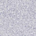 V-ATPase E2 Antibody in Immunohistochemistry (Paraffin) (IHC (P))