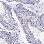 Fascin-3 Antibody in Immunohistochemistry (Paraffin) (IHC (P))
