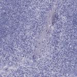 Fascin-3 Antibody in Immunohistochemistry (Paraffin) (IHC (P))