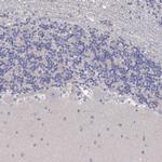 PAPSS2 Antibody in Immunohistochemistry (Paraffin) (IHC (P))