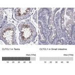 CLTCL1 Polyclonal Antibody