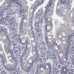 CLTCL1 Antibody in Immunohistochemistry (Paraffin) (IHC (P))