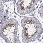 CLTCL1 Antibody in Immunohistochemistry (Paraffin) (IHC (P))