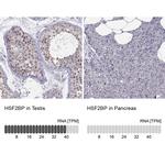 HSF2BP Polyclonal Antibody