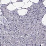 HSF2BP Antibody in Immunohistochemistry (Paraffin) (IHC (P))