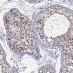 HSF2BP Antibody in Immunohistochemistry (Paraffin) (IHC (P))