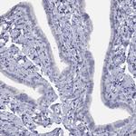 NPL Antibody in Immunohistochemistry (Paraffin) (IHC (P))