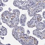 NPL Antibody in Immunohistochemistry (Paraffin) (IHC (P))